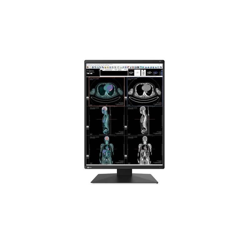 MONITOR EIZO RADIFORCE RX370 3MP COLORE