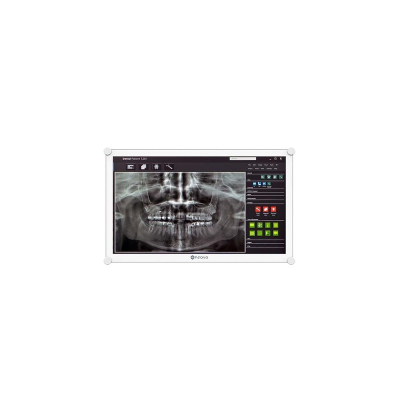 monitor dentale 22